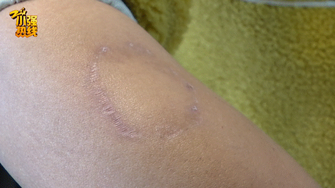 狗血|陌生男子跳进车内连咬司机十几口,还撕破内裤!真相太狗血…