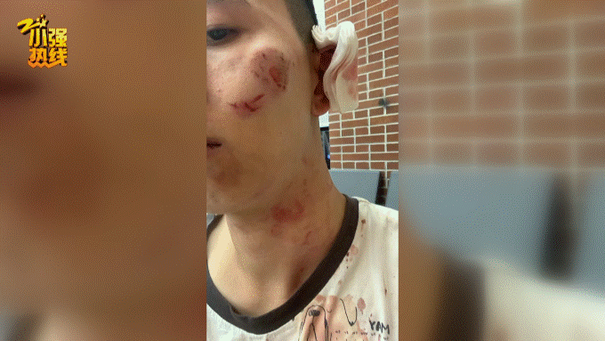 狗血|陌生男子跳进车内连咬司机十几口,还撕破内裤!真相太狗血…