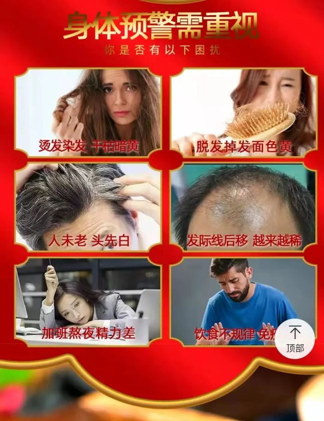 马拉色菌|“补肾”“防脱发”“拯救发际线”,销售火爆的黑芝麻丸真的解决“脱发焦虑?”丨消保委关注