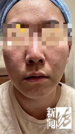 李女士|别拿脸开玩笑！沪上一女子在美容院“做脸”，却越做越没脸见人…
