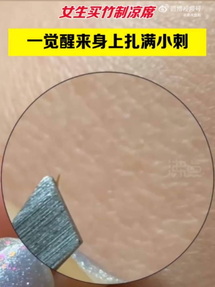 刺猬|真·凉席刺客?女子睡了新买的凉席,一觉醒来身上扎满刺!夏季凉席应该怎么选?